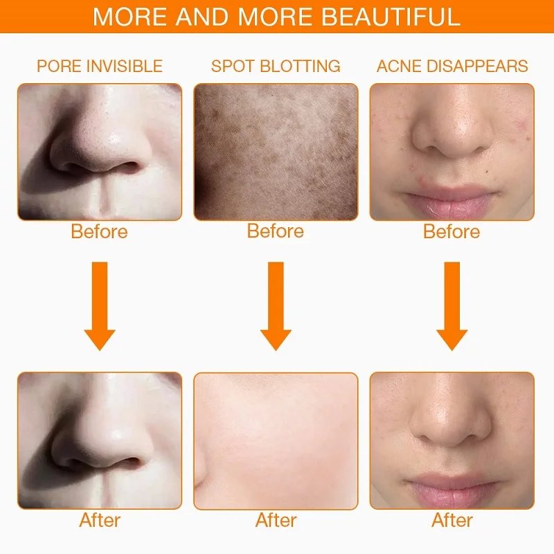 VamsLuna Máscara Facial LED 7 Cores Rejuvenescimento - Imagem 5