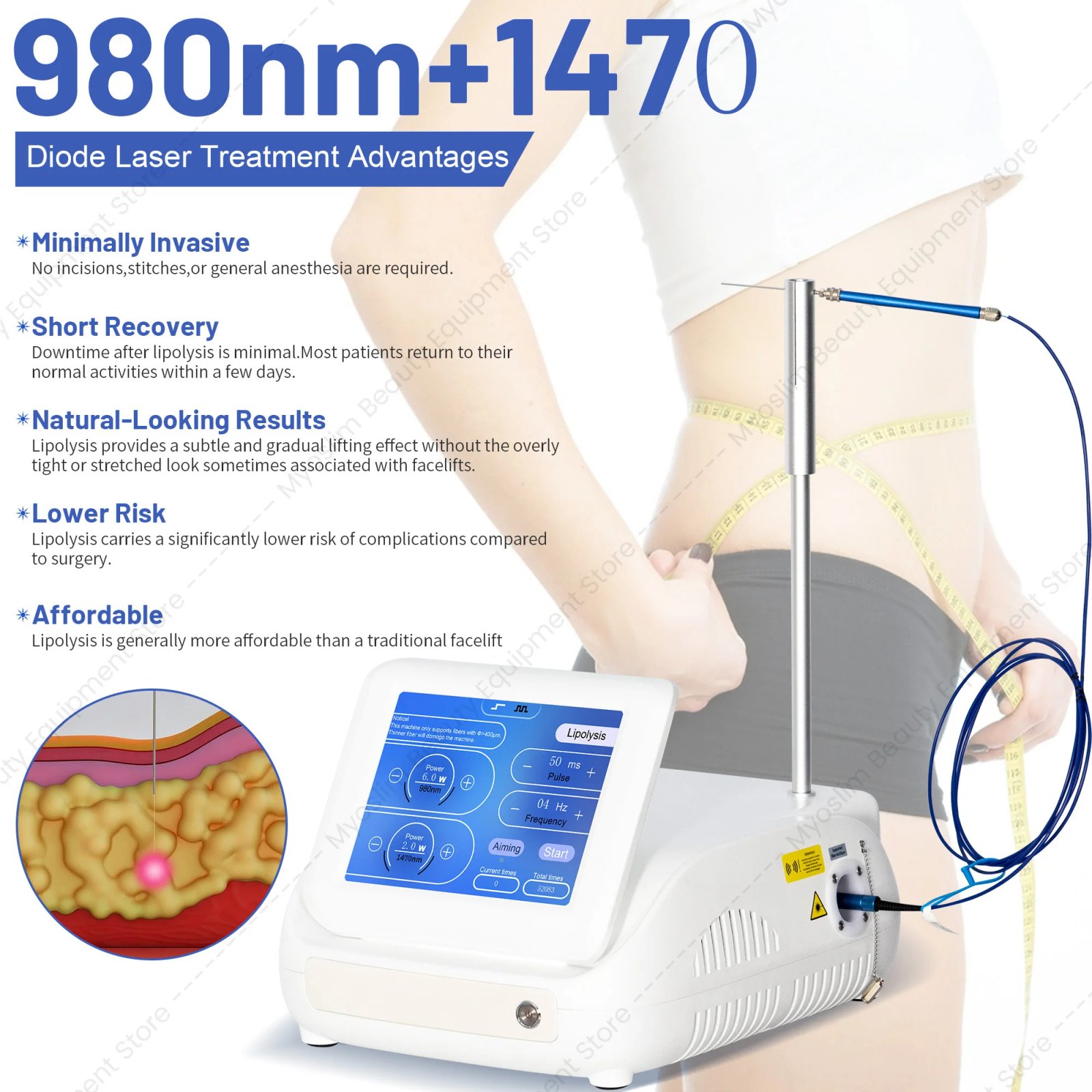 MYOSLIM Aparelho Laser de Diodo 980nm 1470nm para Endolift - Imagem 3