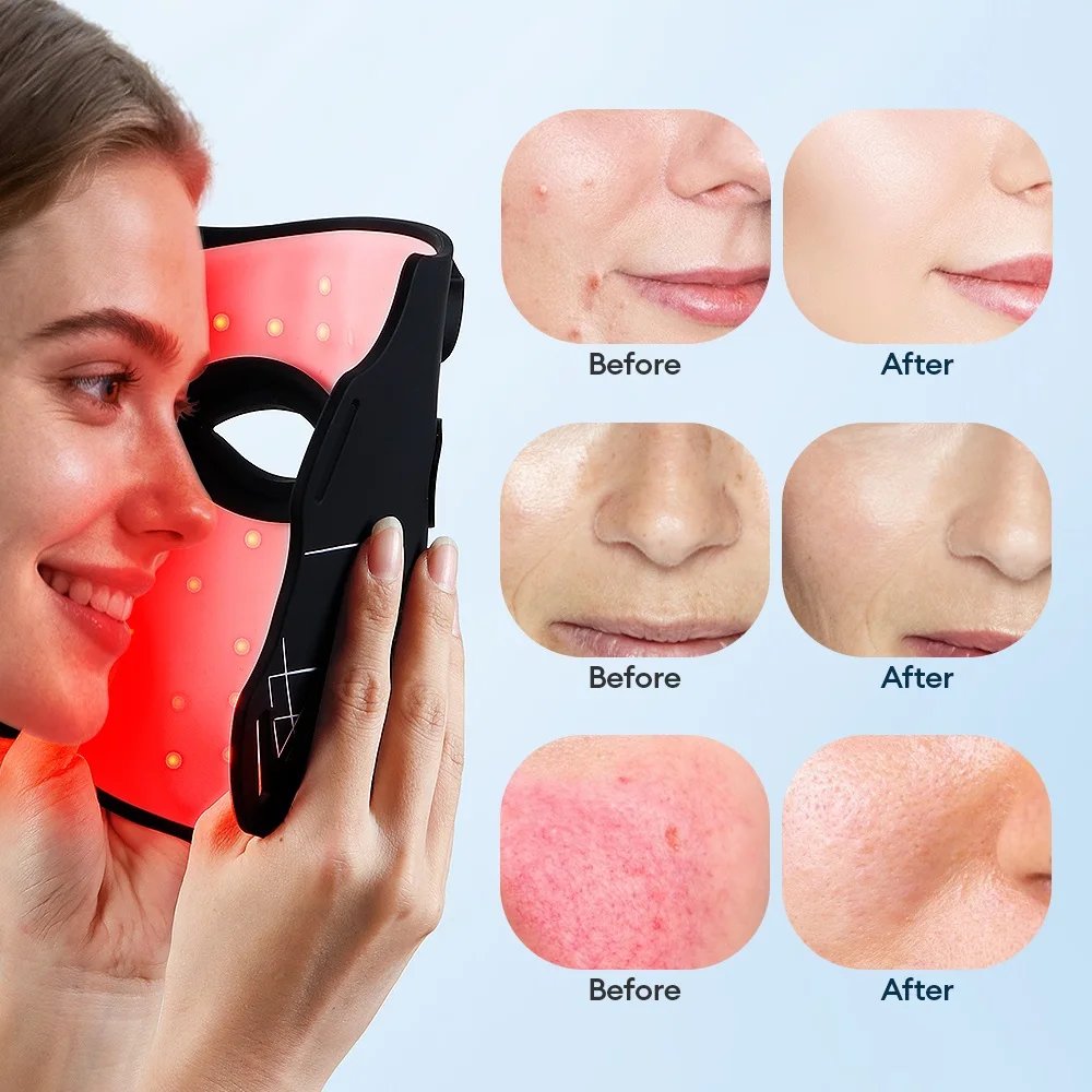Máscara LED Facial Silicone foreverlily 7 Cores Flexível - Imagem 4