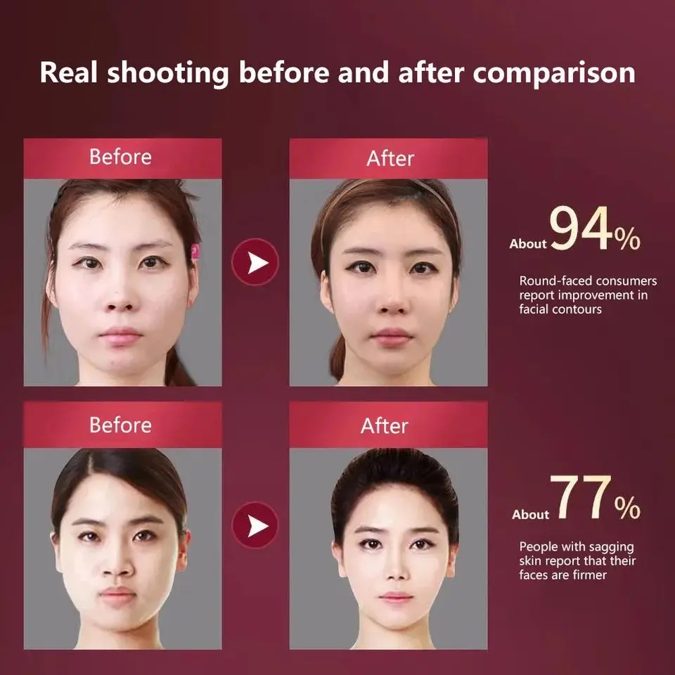 CAMMUO Massageador Facial Elétrico V-line 12 Níveis Vibratórios - Imagem 3