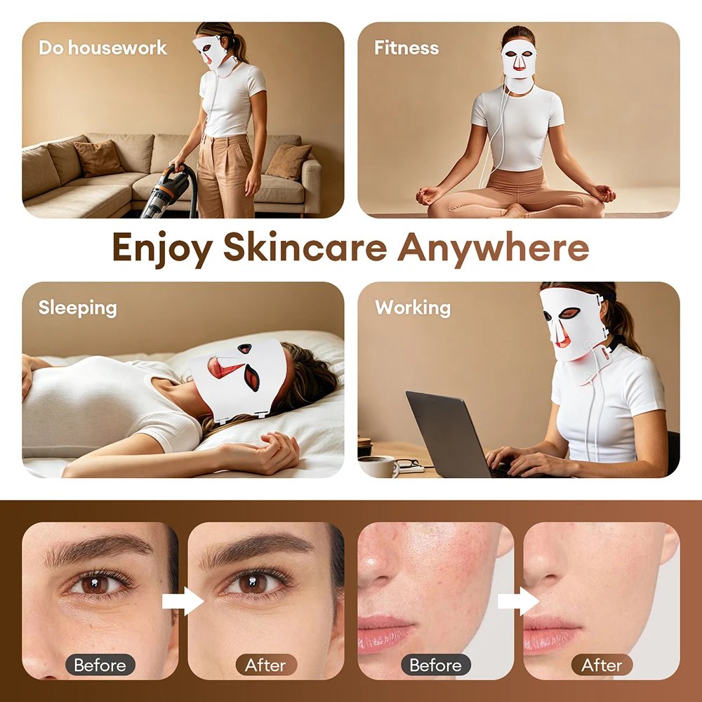 Foreverlily Máscara LED Silicone Facial e Pescoço 105 LEDs 7 Cores - Imagem 6