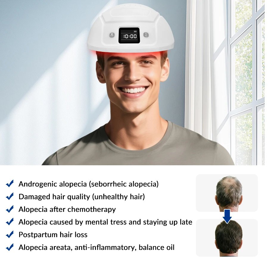 zjzk Capacete de Luz Vermelha 650nm 360 Diodos LCAP360 Branco - Imagem 2