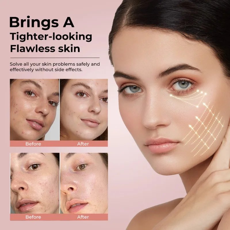 Beauty Introducer Aparelho Facial LED 7 Cores - Imagem 2