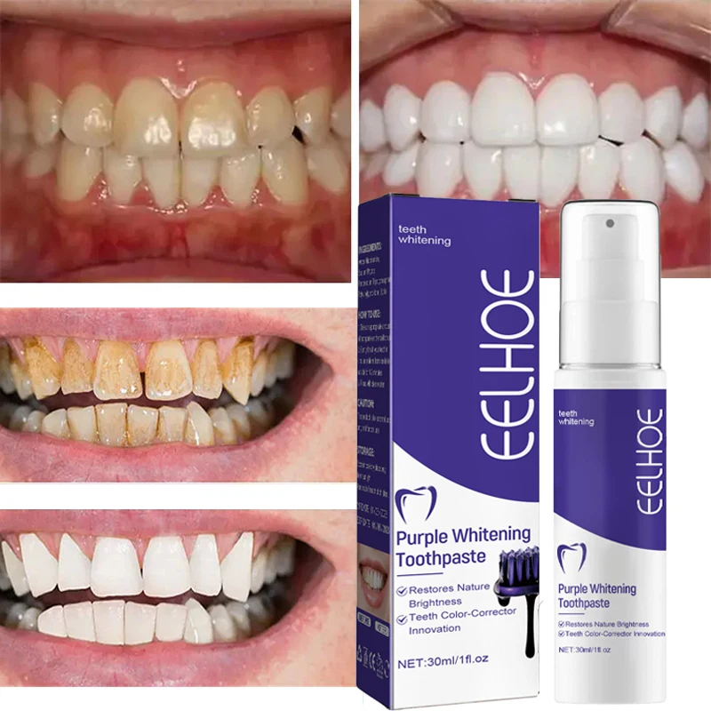 Whiten Gel Creme Dental Clareador Roxo para Limpeza dos Dentes - Imagem 5