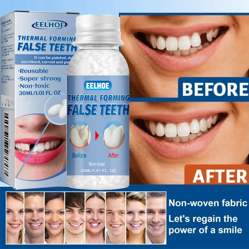 Pérolas Temporárias para Reparo Dental Branco - Imagem 3