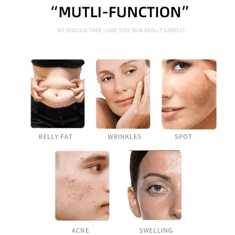 Massageador Corporal Ultrassônico Portátil Branco - Imagem 3
