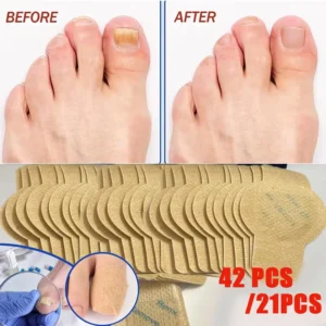 adesivo corretor de unhas