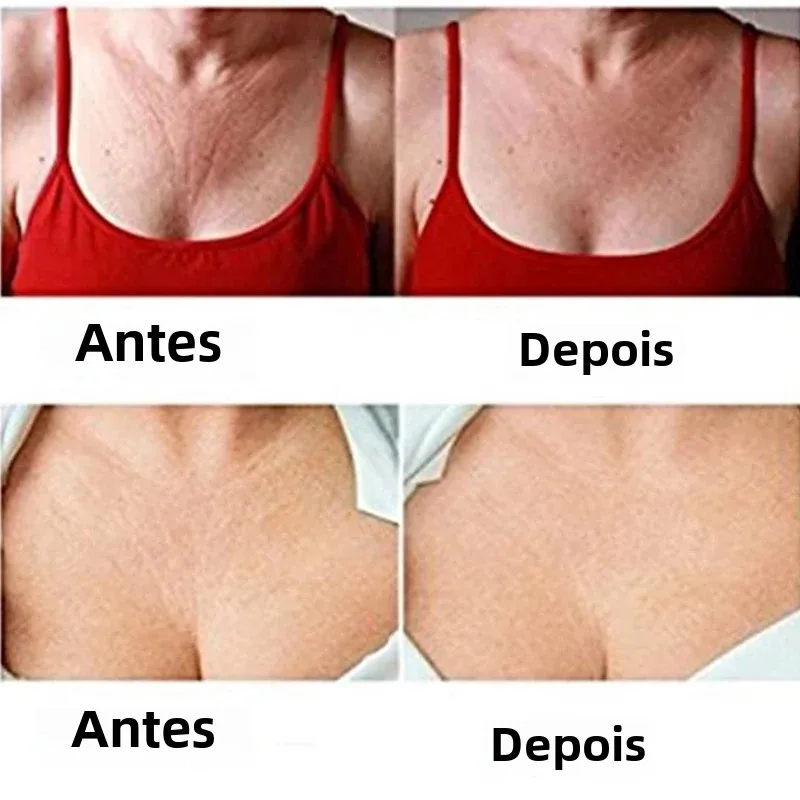 Almofadas de Silicone para o Peito Anti-Rugas - Imagem 3