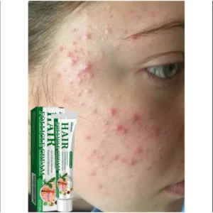 creme facial de essência