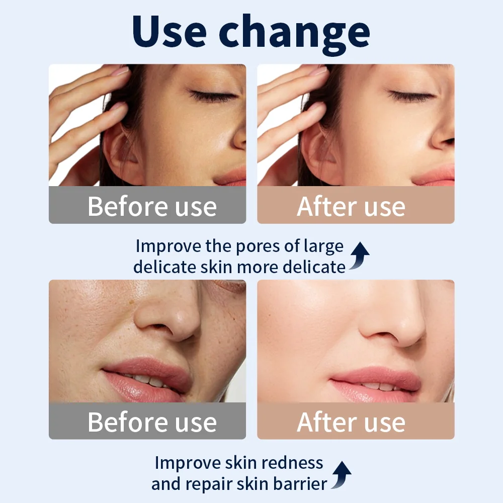 Ubilli Máscara LED Facial 7 Cores para Cuidado da Pele - Imagem 5