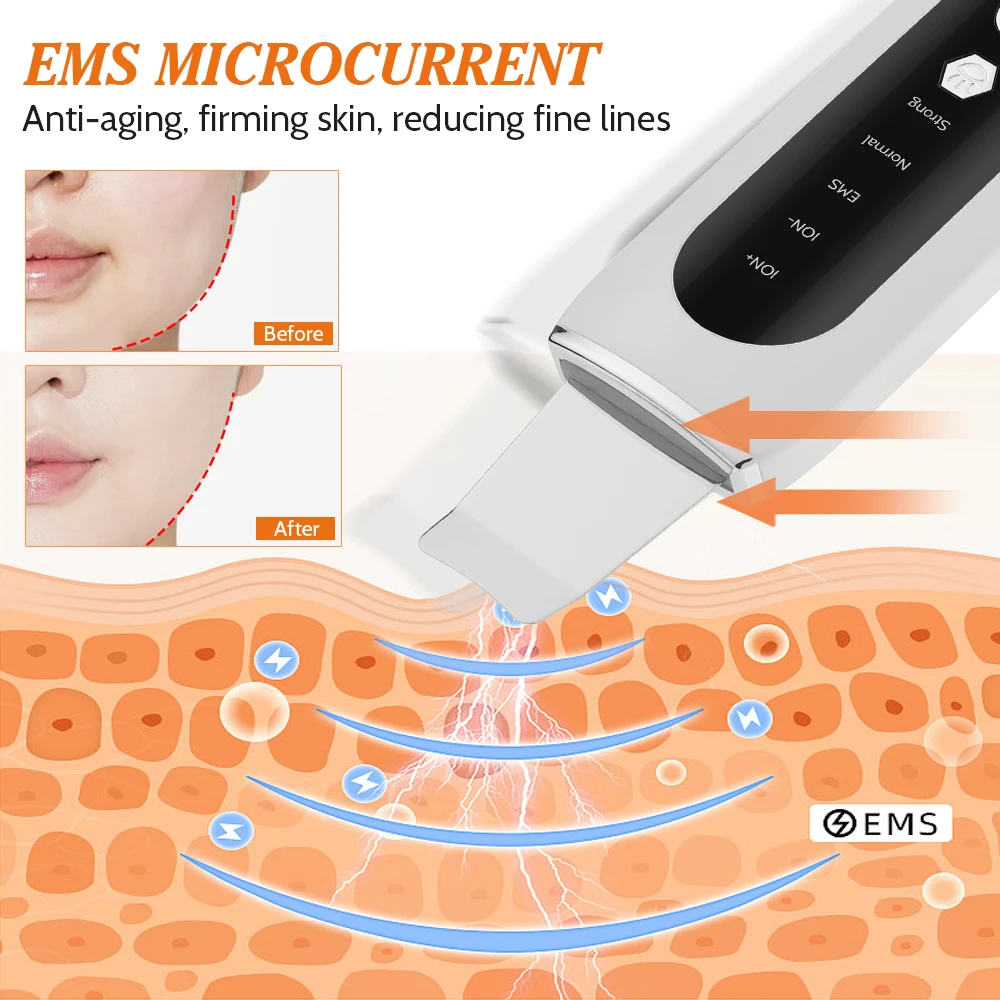 Purificador Ultrassônico de Pele Pá Facial Ouro - Imagem 2