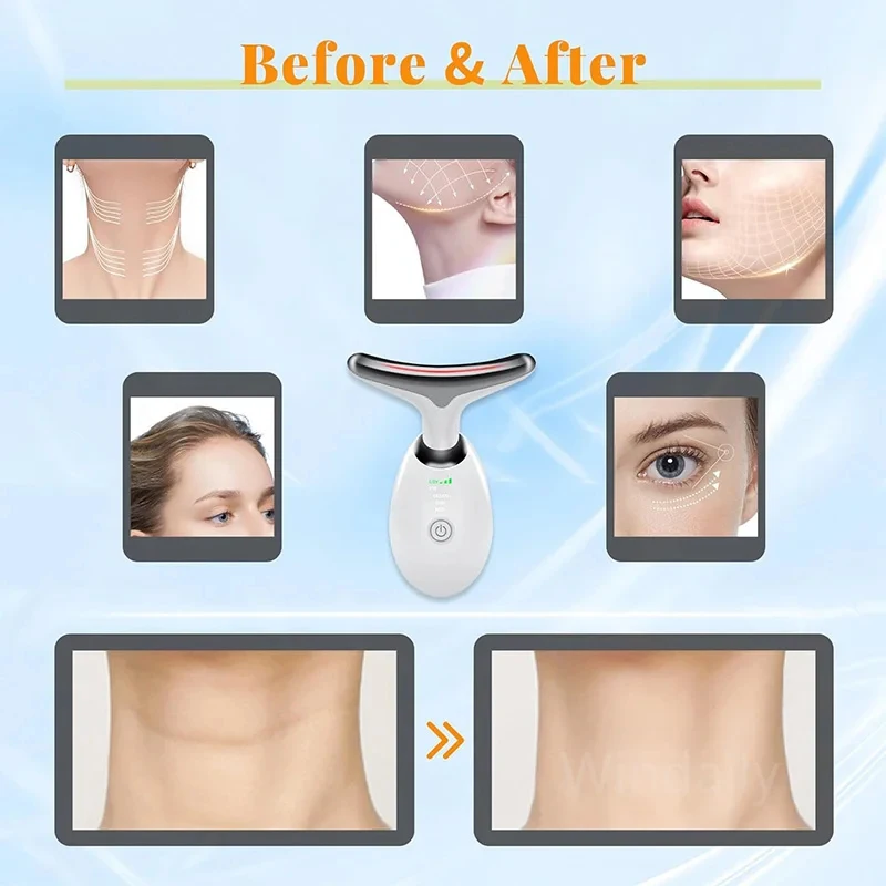 Dispositivo de Beleza Pescoço 7 Cores Massageador Facial Slim - Imagem 3