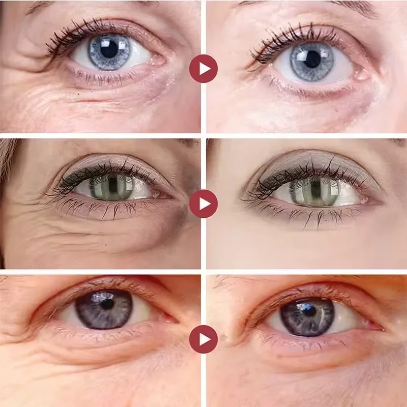 Creme com Retinol para a Área dos Olhos - Imagem 3