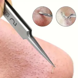 kit extrator de cravos e acne