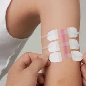 zipper band-aid fechamento de ferida