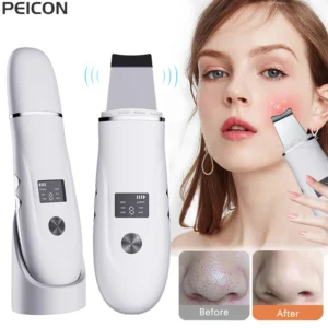 aparelho de peeling ultrassônico facial