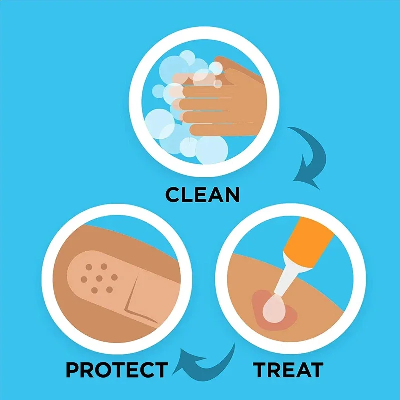Band-aid Adesivo PE Respirável Primeiros Socorros 100 Unidades - Imagem 4