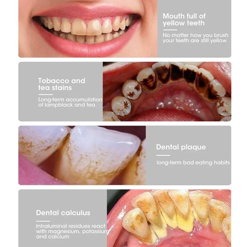 Escova Dental Elétrica Sônica 3 em 1 USB para Limpeza Bucal - Imagem 6