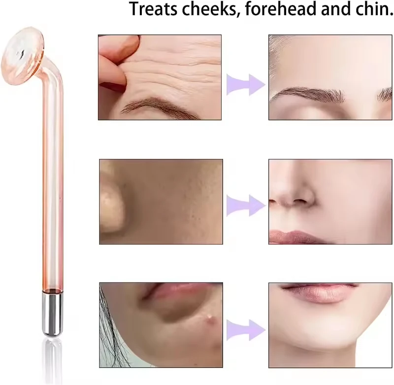Eletrodo de Alta Frequência Tipo Cogumelo para Aparelho Facial - Imagem 2
