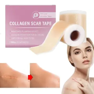fita de silicone para cicatrizes