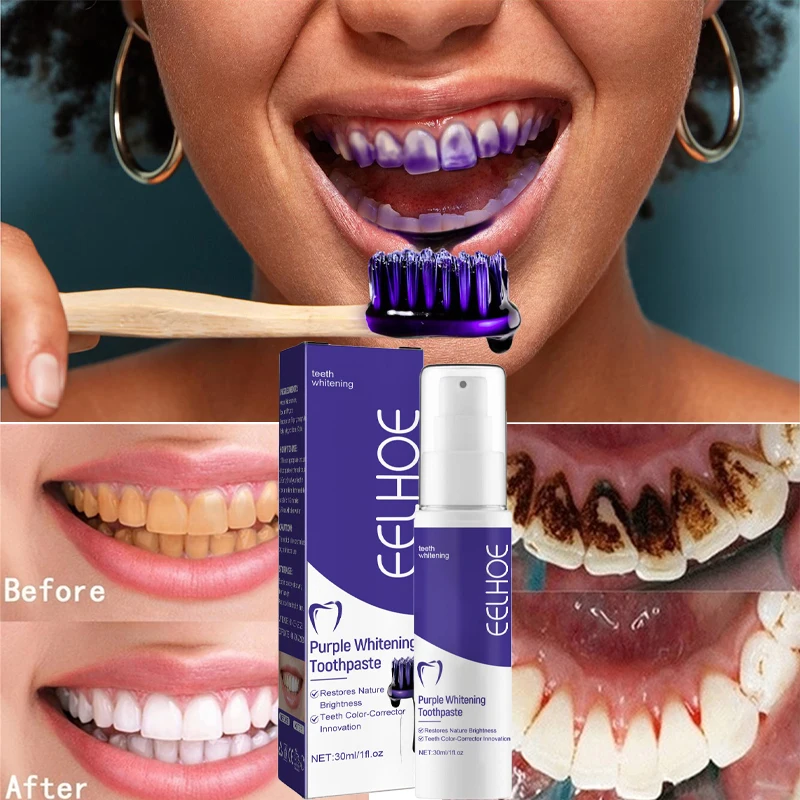 Whiten Gel Creme Dental Clareador Roxo para Limpeza dos Dentes - Imagem 3
