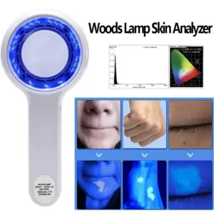 analisador de pele lâmpada de wood