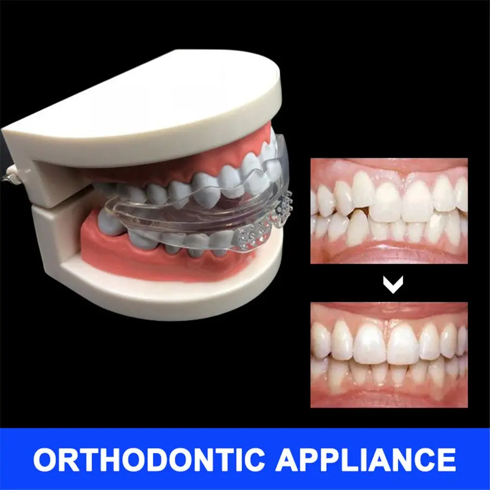 Retentor Dental TPE Ortodôntico para Alinhamento - Imagem 4