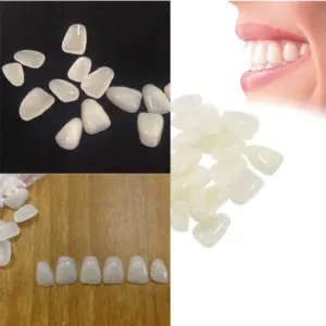 folheados de resina para dentes