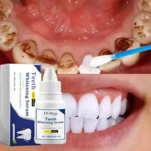 soro para limpeza de dentes