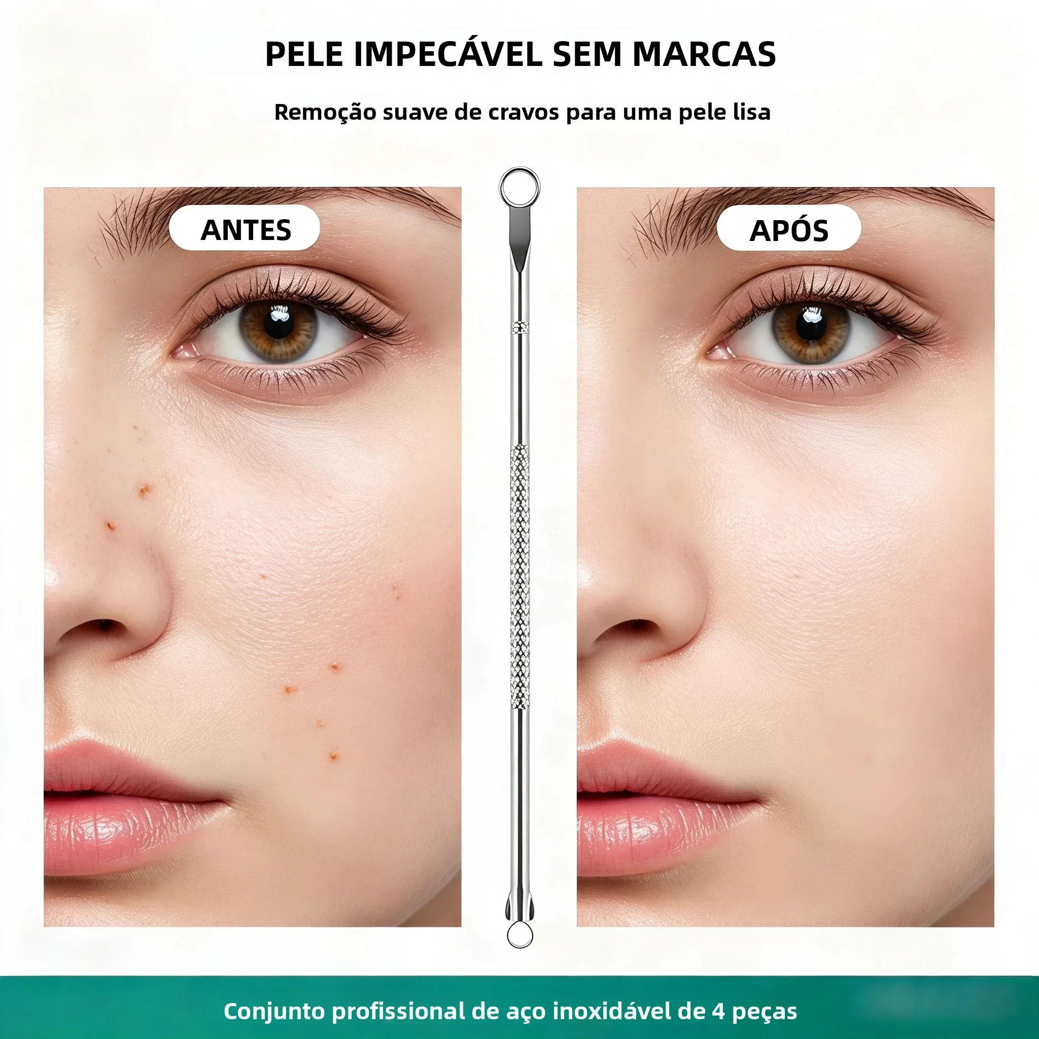 Kit Extrator de Cravos e Espinhas em Aço Inoxidável 8 Peças - Imagem 5
