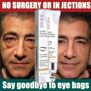 creme para olhos com retinol