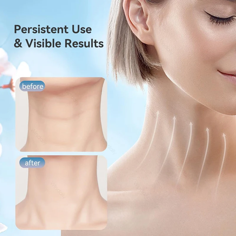 Dispositivo de Beleza Facial Pescoço Microcorrente EMS Azul Escuro - Imagem 5