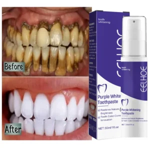 creme dental clareador roxo