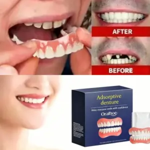 conjunto de dentaduras