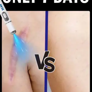 lâmina de gel de silicone