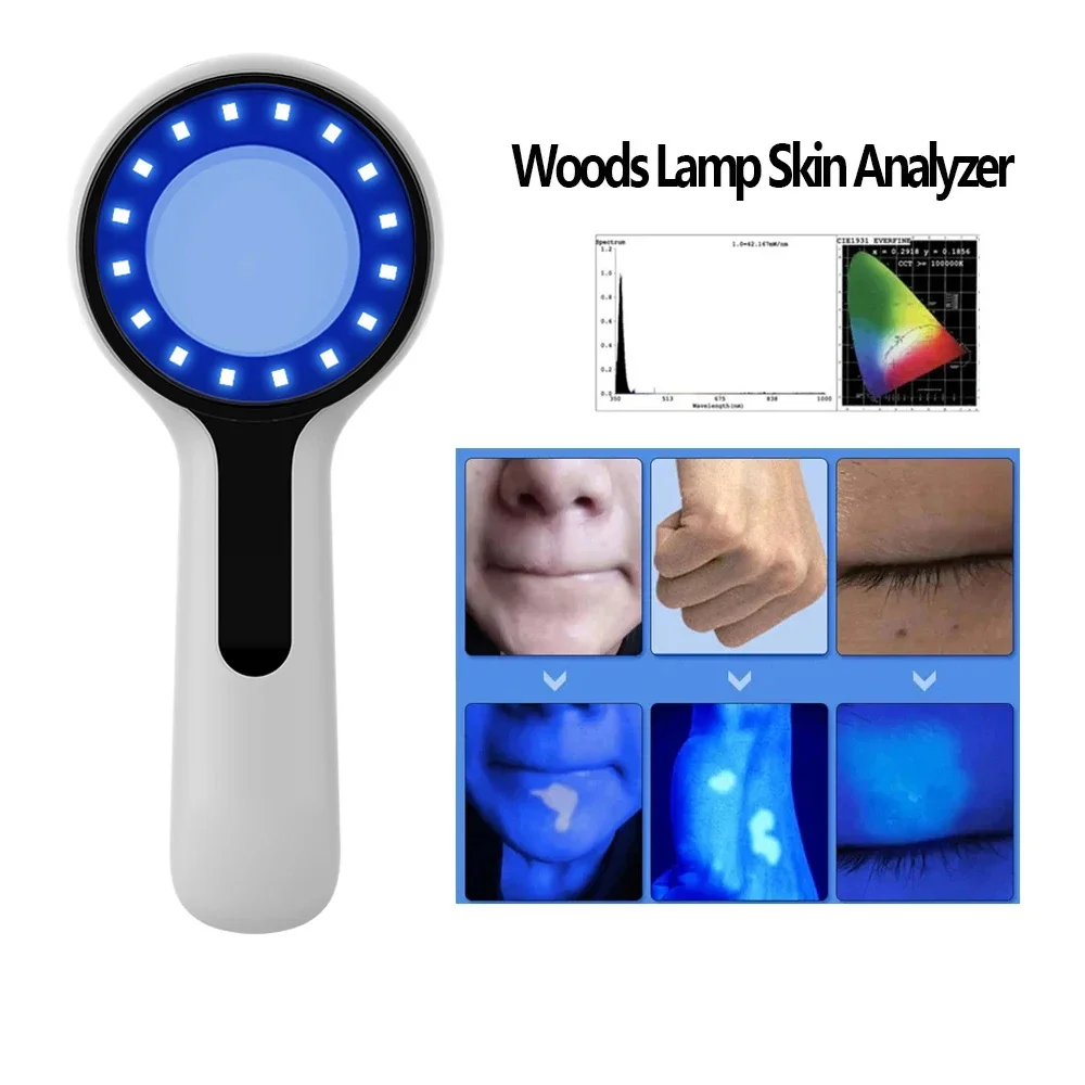 Analisador de Pele Lâmpada de Wood Portátil LED Ouro - Imagem 2