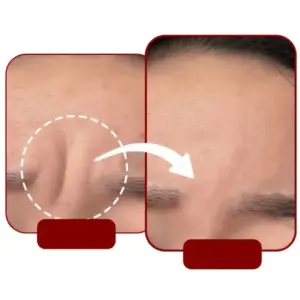 adesivo de silicone para testa