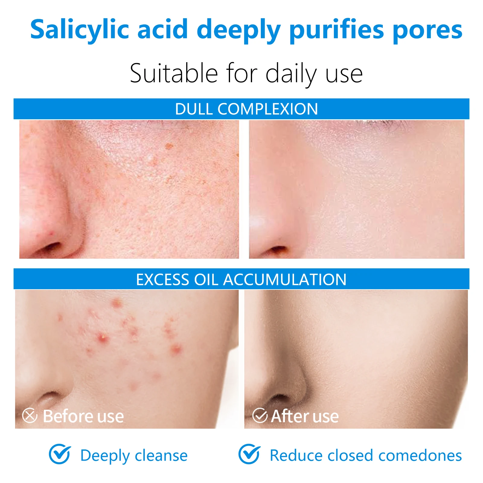 Almofada Tonificante Facial Dupla Ação AHA BHA - Imagem 6