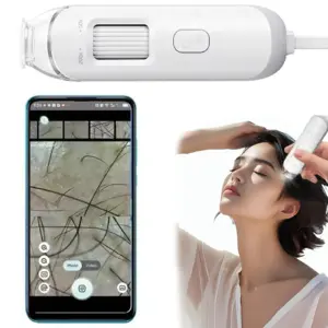 dermatoscópio eletrônico USB HD