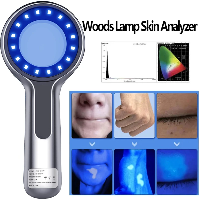 Analisador de Pele Lâmpada Wood DW-B200 - Imagem 6