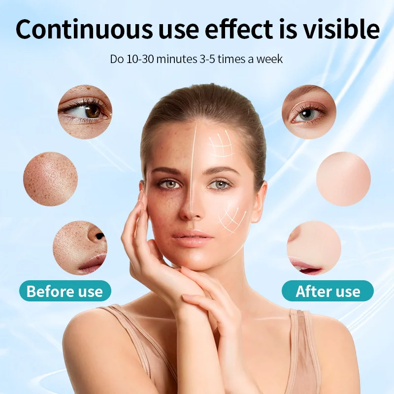 Ubilli Máscara LED Facial 7 Cores para Cuidado da Pele - Imagem 4