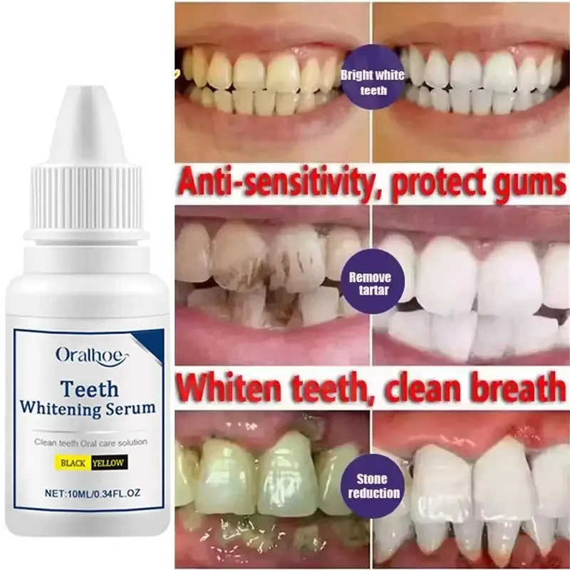 Soro para Limpeza e Branqueamento de Dentes - Imagem 3