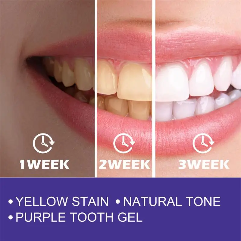 Whiten Gel Creme Dental Clareador Roxo para Limpeza dos Dentes - Imagem 4