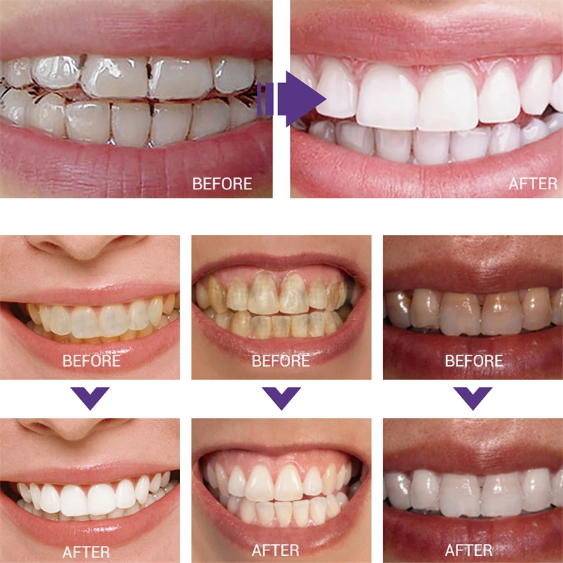 Whiten Gel Creme Dental Clareador Roxo para Limpeza dos Dentes - Imagem 2
