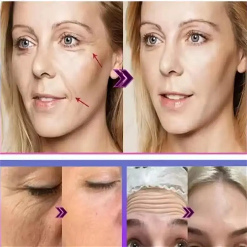 Creme Facial Anti-Idade Lifting Hidratante - Imagem 2